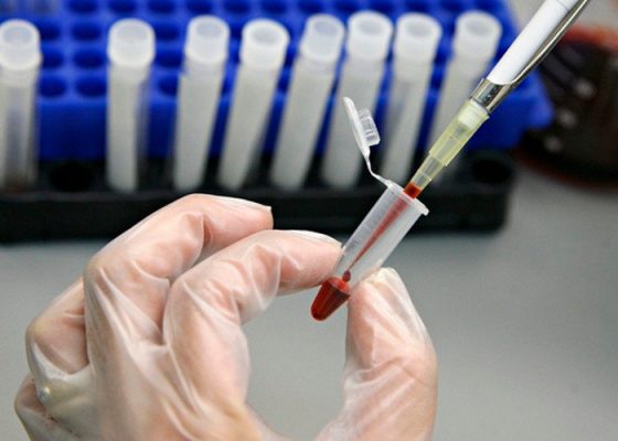 Mối tương quan giữa môi trường lao động và sức khỏe người lao động