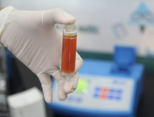 Vi sinh xử lý amoni trong nước thải như thế nào?